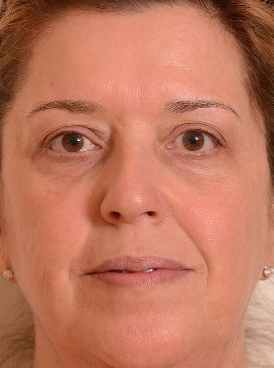 Eudalie krémmel megújítottam az arcomat