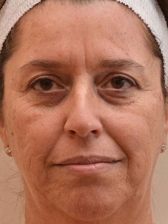 Tehát megnéztem, mielőtt eudalie krémet használtam