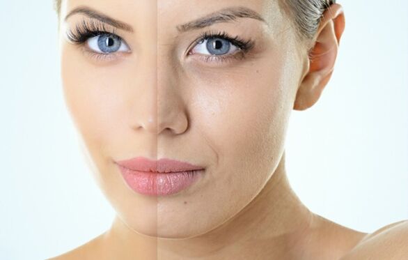 A frakcionált megújulás jelzései