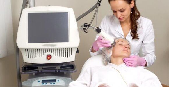 Az eljárás végrehajtása