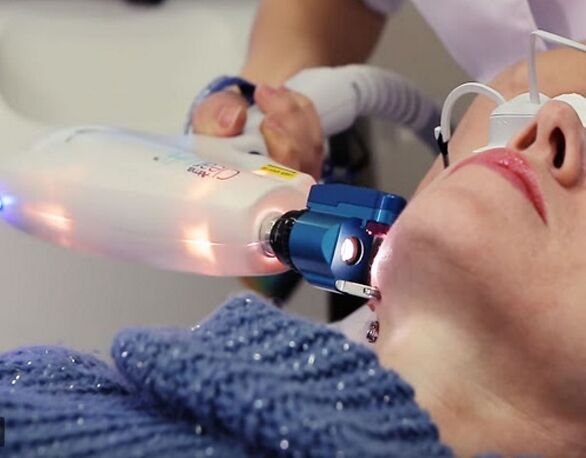 A bőr tökéletlenségei elleni küzdelem